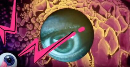 img25
